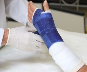 Broken arm compensation